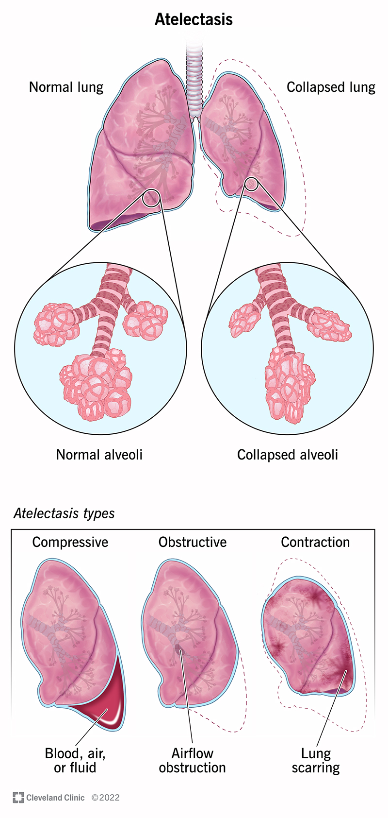 my.clevelandclinic.org