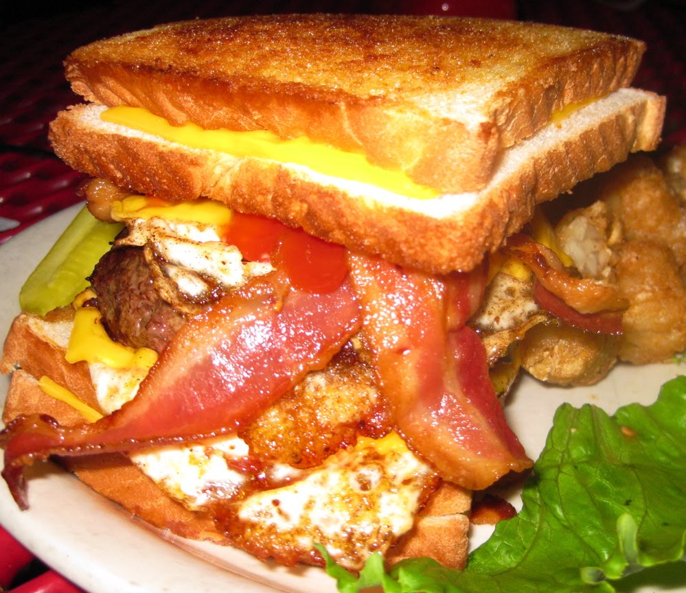 doublebypass.JPG