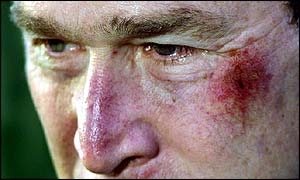 _1759881_newbush300bruise.jpg