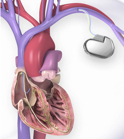 www.heart.org