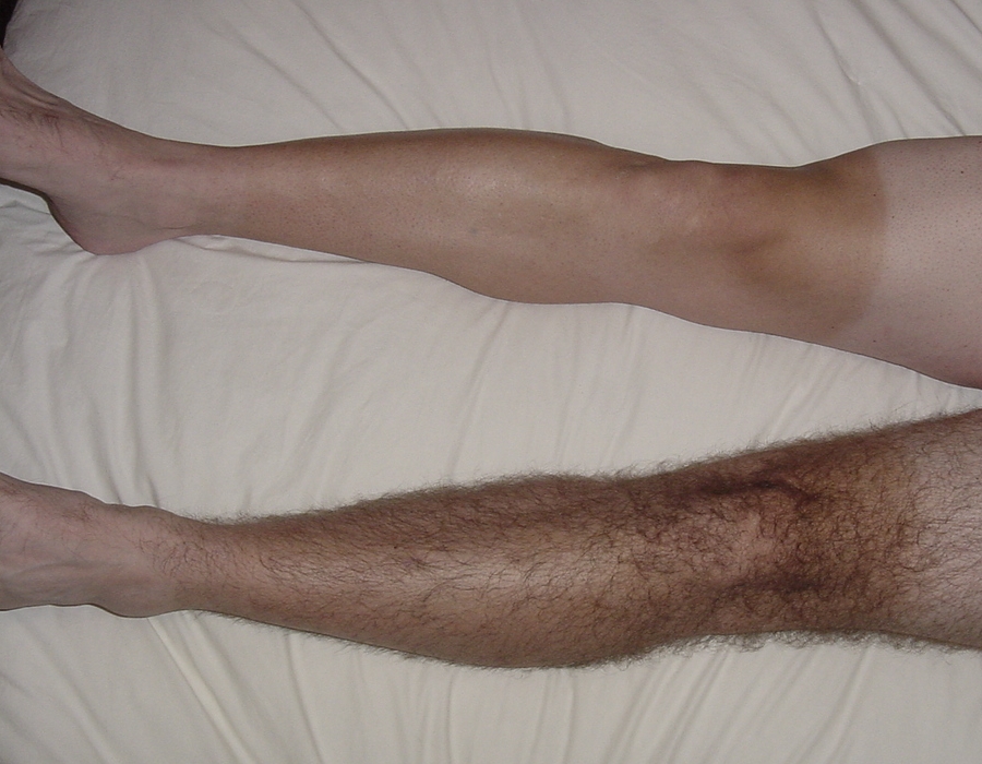 legs.jpg