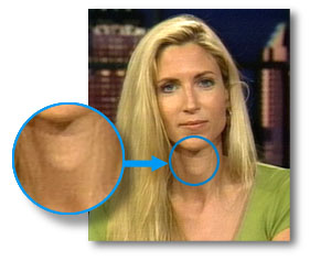 coulter.jpg