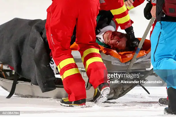 simon-ammann-of-switzerland-receives-medical-treatment-after-his-crash-on-day-8-of-the-four.webp